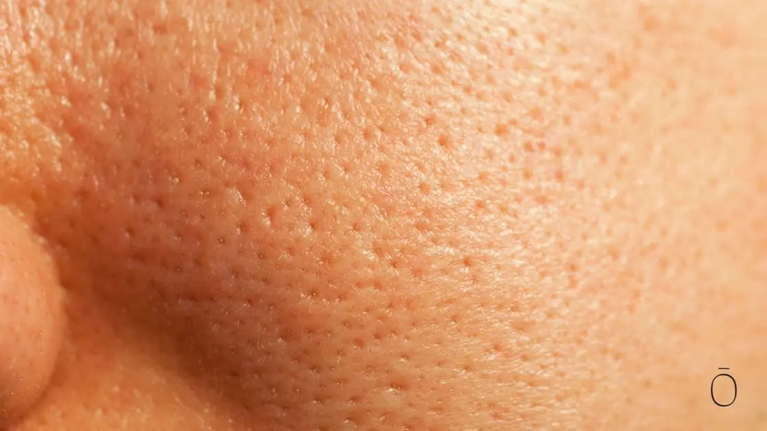 Riduzione pori viso: 7 Ampoule per un Aspetto Levigato
